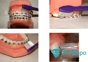 牙套君如何正確清潔牙齒與通用鞋類護理指南